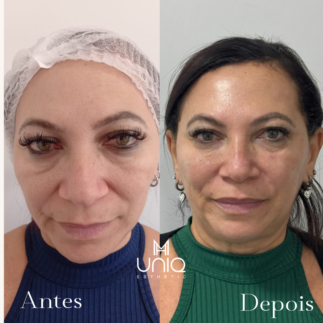 Ante_20250814_112329_0000