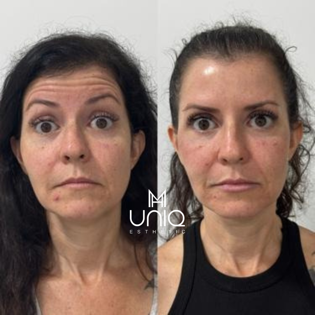 Beige Minimalist Skincare Before and After Instagram Post_20250602_103021_0000