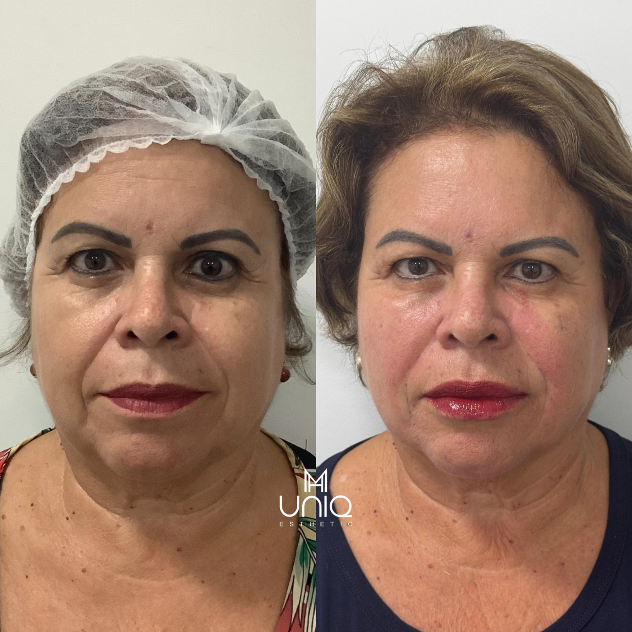 Design sem nome_20250820_105730_0000