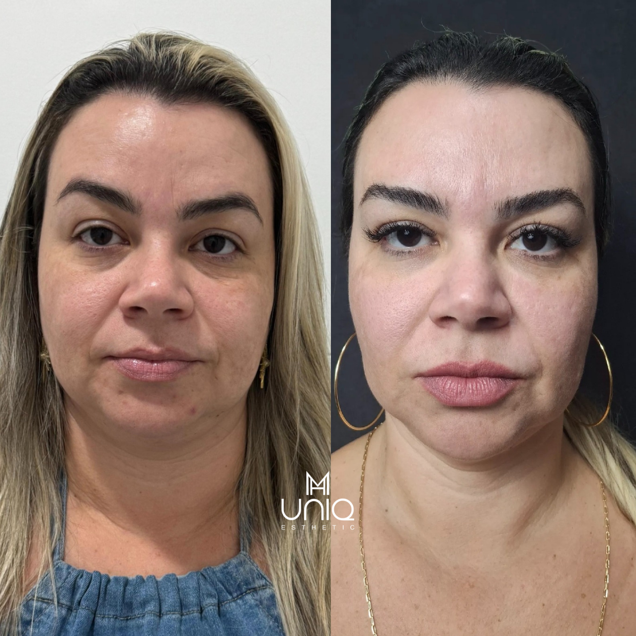 Design sem nome_20250820_110739_0000